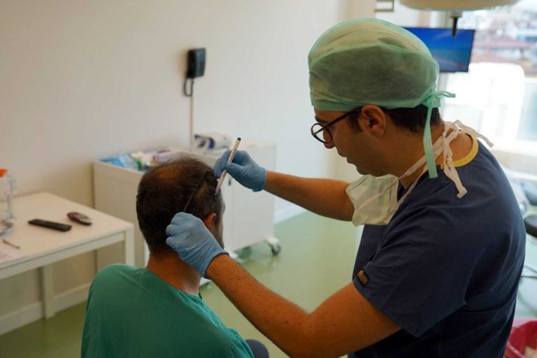 Hair Transplant UK: Advanced Techniques for Men & Women